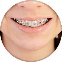 ortodoncia infantil juvenil y adultos